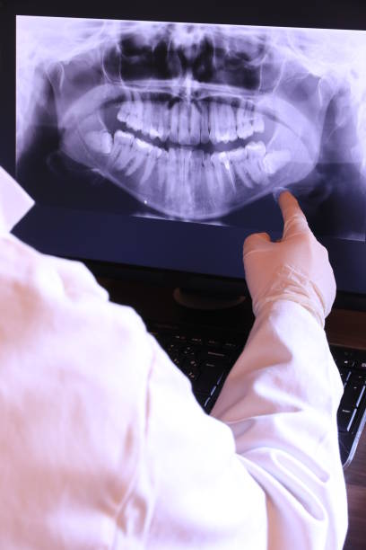 Best Emergency Tooth Extraction in Eidson Road, TX
