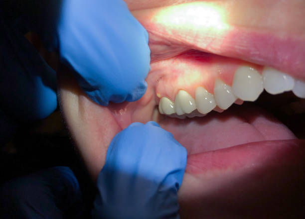 Best Pediatric Emergency Dentist in Eidson Road, TX