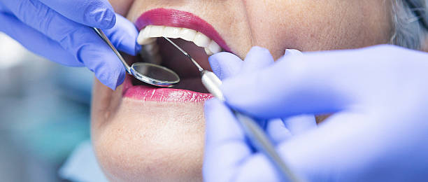 Best Emergency Root Canal Treatment in Eidson Road, TX