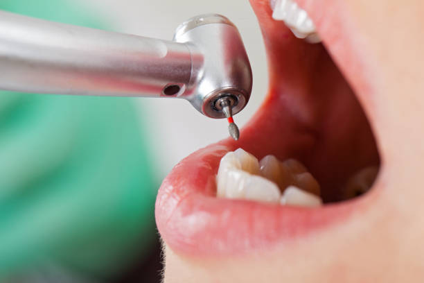 Best Walk-In Emergency Dentist in Eidson Road, TX